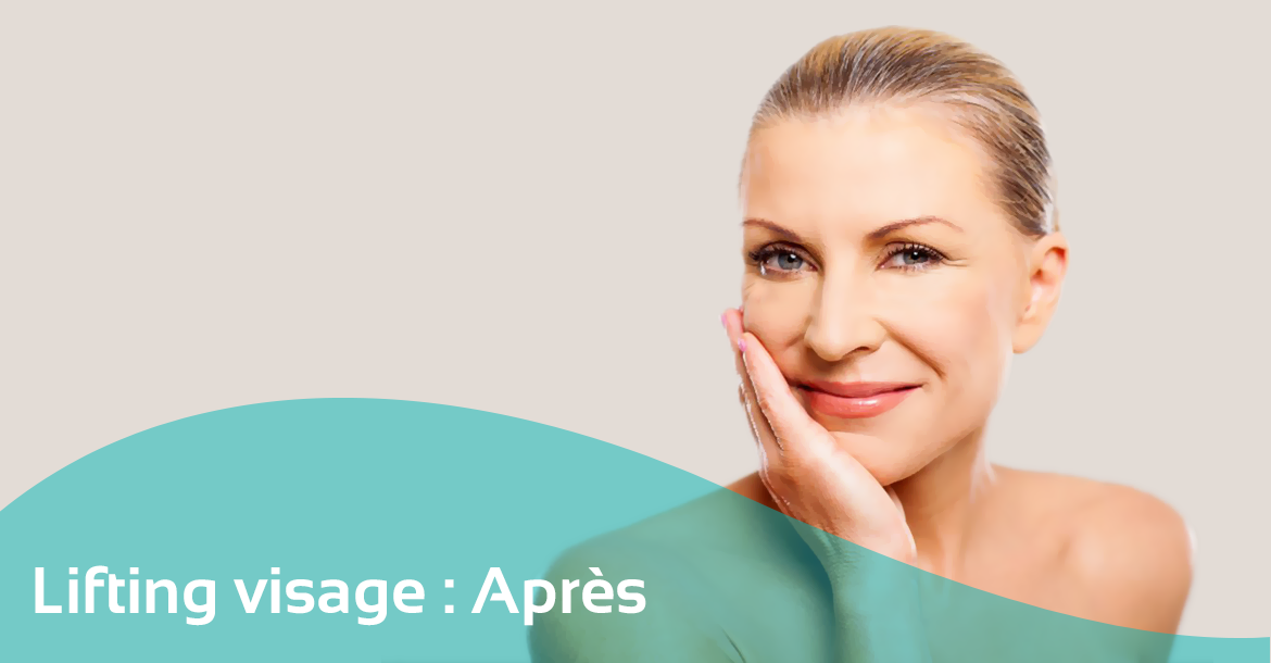 After-Lifting visage