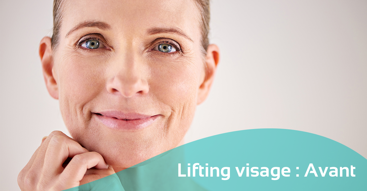 Before-Lifting visage